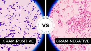 Gram positiv versus gram negativo