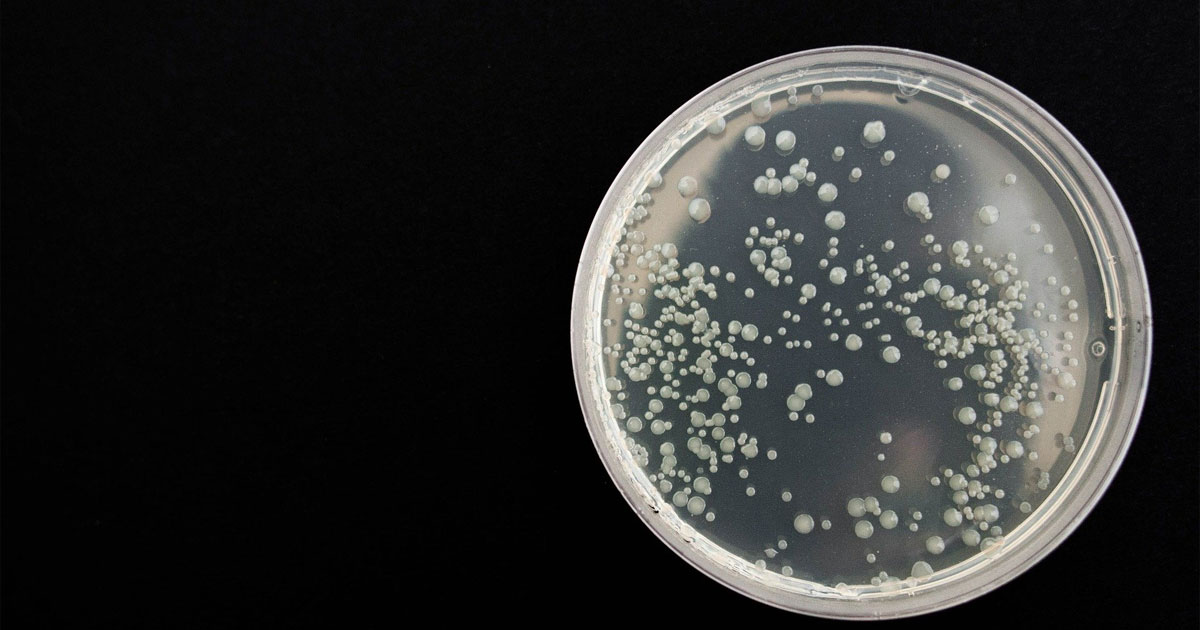 A bactéria Legionella é realmente rara em sistemas de água hospitalares?